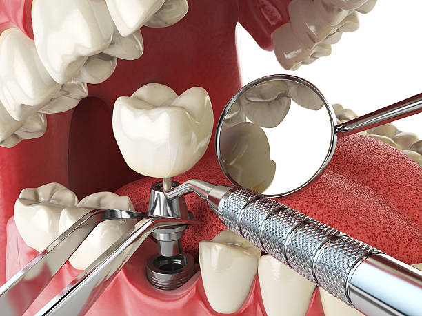 Emergency Gum Pain Relief in OH